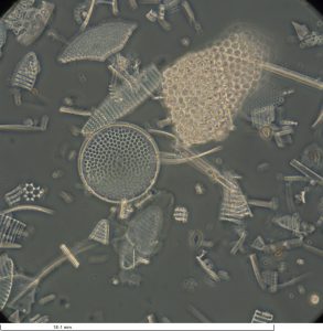 In the center, a round shape with evenly spaced dots – a diatom. Other fragments around.