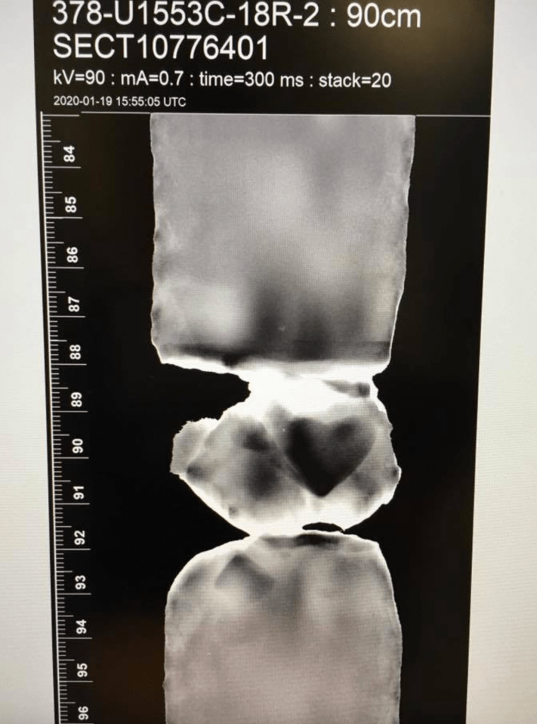 An X-ray image of a core. There are two sections of core at the top and bottom, and one small chunk in the middle. The X-ray is unremarkable except for a dark spot in the broken piece, in the perfect shape of a heart symbol. The label denotes this as core U1553C-18R-2.