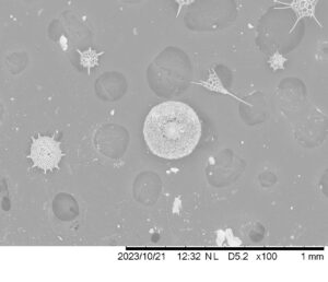 SEM image of several radiolarians.